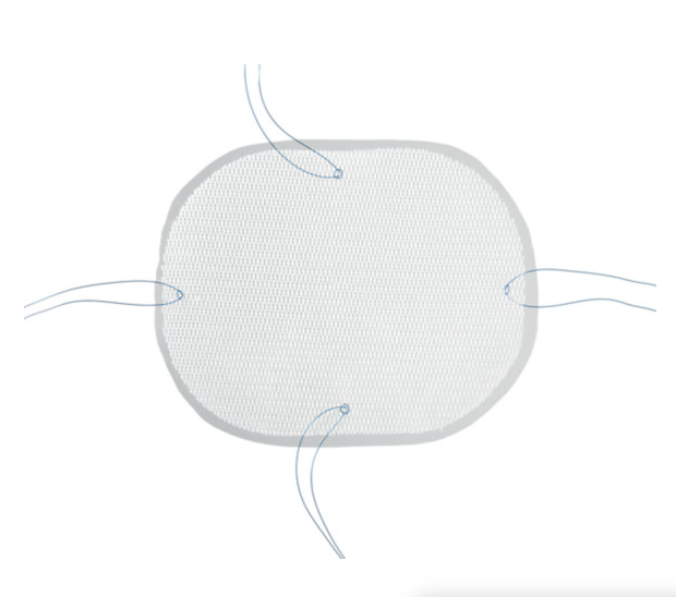 PCO2015FX Сетка для грыжи